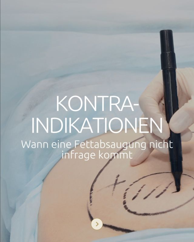 ❗️Wichtige Infos zur Fettabsaugung ❗️
Nicht jeder Eingriff ist für jede Person geeignet und das ist auch gut so.
In unserem neuen Karussell klären wir auf:
🔍 Was sind Kontraindikationen?
🚫 Welche absoluten und relativen Ausschlusskriterien gibt es?
✅ Wann ist ein Eingriff sinnvoll?
🤝 Und warum eine fundierte Beratung unerlässlich ist.  Deine Gesundheit steht an erster Stelle.
💬 Du hast Fragen oder möchtest dich individuell beraten lassen? Dann melde dich jetzt bei uns – wir sind für dich da!