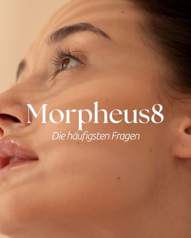 ✨ Straffere Haut ohne OP – klingt zu schön, um wahr zu sein?
Morpheus8 kann genau das möglich machen. Im Karussell beantworten wir die häufigsten Fragen rund um die Behandlung!  📲 Du willst wissen, ob Morpheus8 zu deinem Hautbild passt?
Dann buch dir jetzt einen Beratungstermin – Link in Bio