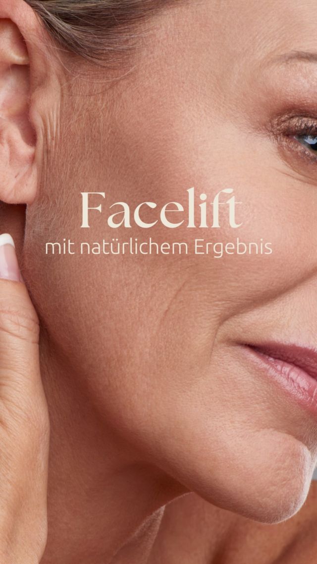 Du hast Angst, nach einem Facelift unnatürlich oder „gemacht“ auszusehen?  Dann ist es besonders wichtig, dich gut beraten zu lassen!  Denn für ein natürliches Ergebnis müssen einige Punkte beachtet werden:
✨ eine präzise Planung,
✨ eine ehrliche Beratung
✨ Mit der modernen SMAS-Technik straffen wir nicht nur die Haut, sondern auch das tieferliegende Gewebe und weitere Behandlungen wie Eigenfett, Microneedling oder Morpheus8 unterstützen ein natürliches, ausdrucksstarkes Ergebnis.  Meine persönliche Meinung dazu? Ich mag keine überkorrigierten Ergebnisse und stehe für natürliche Facelifts, die deine Persönlichkeit unterstreichen – nicht verändern. 🤍  📍 Wenn du dich für ein natürliches Ergebnis interessierst, lass dich genau beraten! Link in Bio.