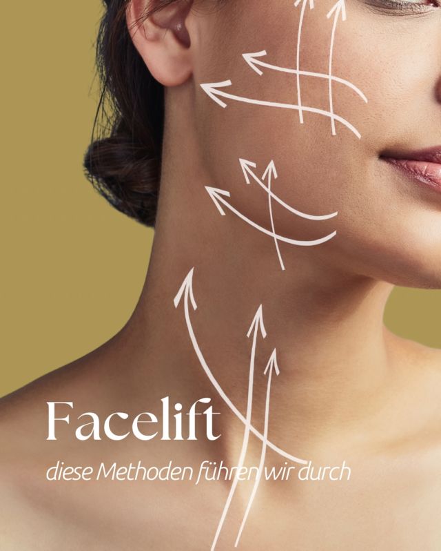 Mit den Jahren verliert die Haut an Elastizität und Ausstrahlung, deshalb wünschen sich viele Patient*innen wieder Frische und jugendliche Konturen.  👉🏻Dort, wo Hautpflege, Filler und Fadenliftings an ihre Grenzen stoßen, kommt das Facelift ins Spiel, um ein langanhaltendes und trotzdem natürliches Ergebnis zu erzielen.  ✨In unserer Klinik bieten wir verschiedene Möglichkeiten des Facelifts an - von minimalinvasiven bis zu komplexen chirurgischen Eingriffen.  In einem persönlichen Beratungsgespräch gehen wir auf die individuellen Wünsche und Vorstellungen ein und besprechen gemeinsam, welche Behandlung geeignet ist.  #facelift #facelifting #deepplane #smas #drjulianebodo