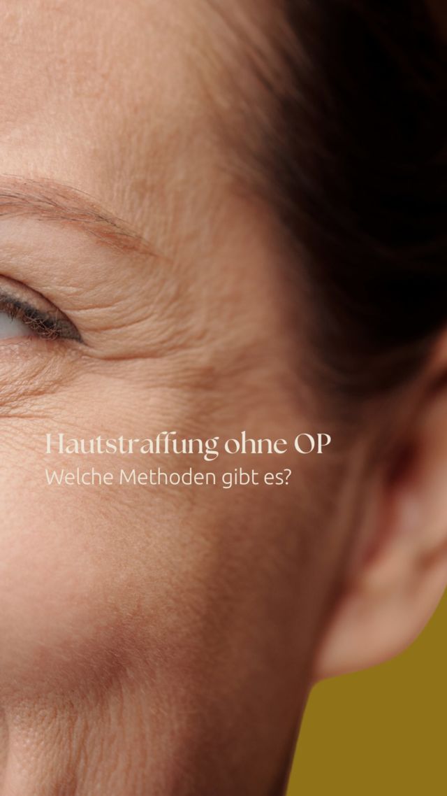 Du möchtest straffere Haut, fühlst dich aber noch zu jung für ein klassisches Facelift? ✨  Keine Sorge – es gibt mittlerweile viele schonende Möglichkeiten, Haut zu festigen und die Gesichtskonturen zu definieren, ganz ohne Lift.
Im Reel erkläre ich dir, welche Behandlungen sinnvoll sind und wann sie wirklich wirken.  👉🏻 Buche gerne einen Beratungstermin über unsere Website, um herauszufinden, welche Methode zu dir passt.