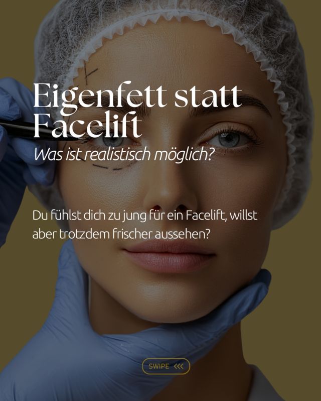 Eigenfett statt Facelift – was ist realistisch möglich? 💉✨
Viele wünschen sich mehr Frische, definierte Konturen und weniger Falten, aber ohne großen Eingriff. Mit Eigenfett kann man genau das erreichen: natürliches Volumen, Regeneration und ein harmonisches Gesamtbild.  Wichtig: Ein Lipofilling ersetzt kein Facelift. Es kann aber dort unterstützen, wo Volumen fehlt und die Haut noch elastisch genug ist.  👉🏻 Wenn du wissen willst, ob Eigenfett für dich sinnvoll ist oder ob eine andere Methode besser passt, buche gerne einen Beratungstermin über unsere Website.