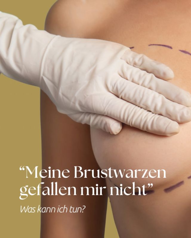 Nicht jede Brustwarzenkorrektur ist gleich und auch nicht jede braucht eine große OP.
Manchmal reicht eine lokale Betäubung, z. B. bei kleinen Anpassungen in Form oder Größe.  👉🏻 Wenn jedoch gleichzeitig eine Bruststraffung oder -vergrößerung geplant ist, wird die Korrektur meist im gleichen Eingriff durchgeführt – so kann das Ergebnis harmonisch angepasst werden.  💬 Brustwarzen sind super individuell.
Wenn du wissen möchtest, was in deinem Fall möglich ist, buch dir gerne einen Termin über unsere Website.